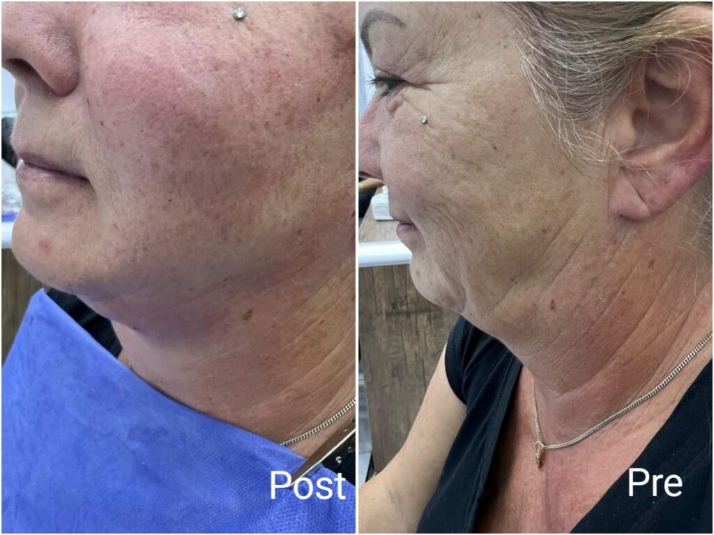 شد الرقبة في الغردقة